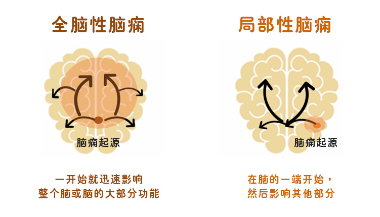 脑痫发作分两大类